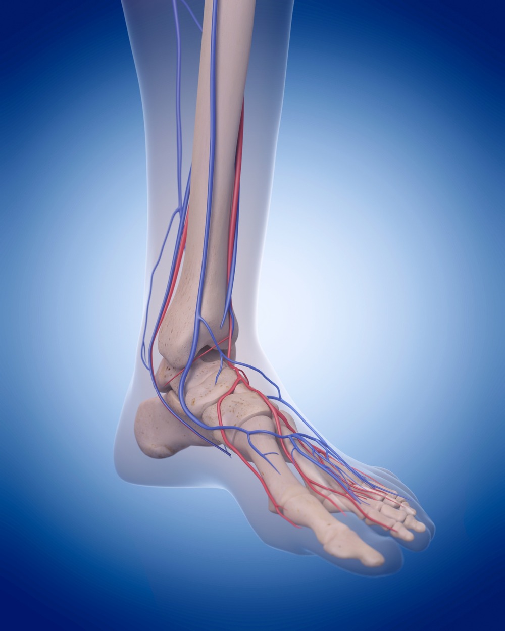 Vein Mapping scan to check the competency of the valve, size of the veins and blood flow in the large veins in the legs and checking for Chronic Venous Insufficiency (CVI)