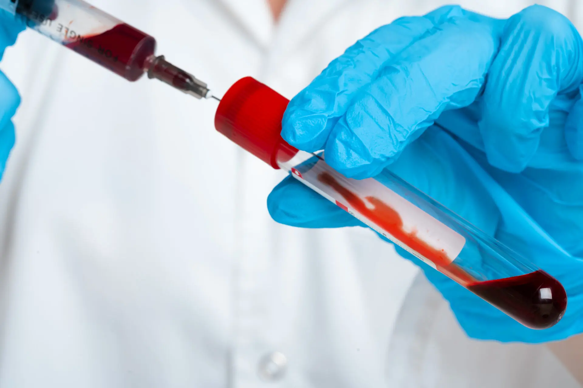 Elite Community Ultrasound offers professional blood testing services to monitor your health