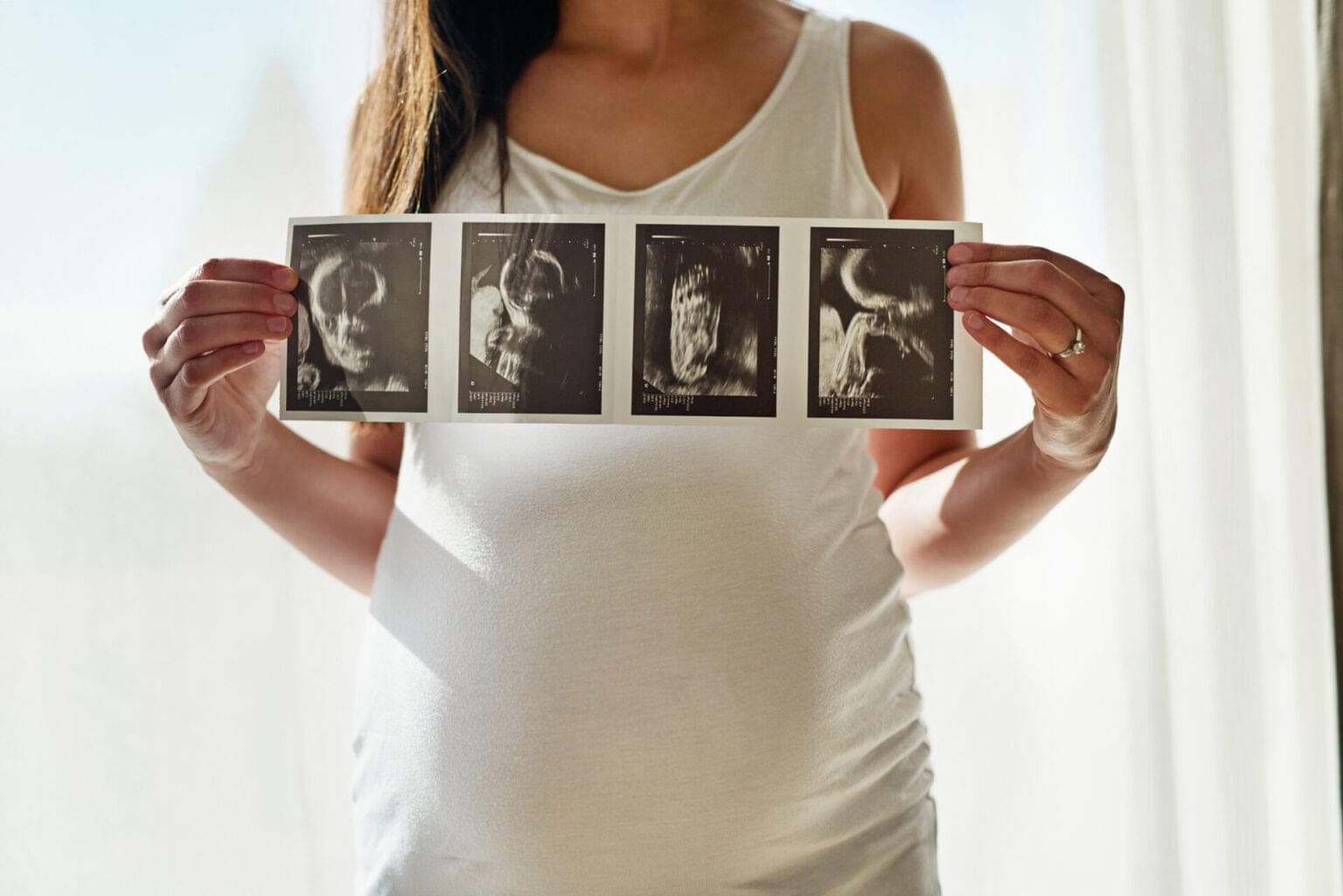 Early Pregnancy & Baby Scan | Private Ultrasound Elite Community