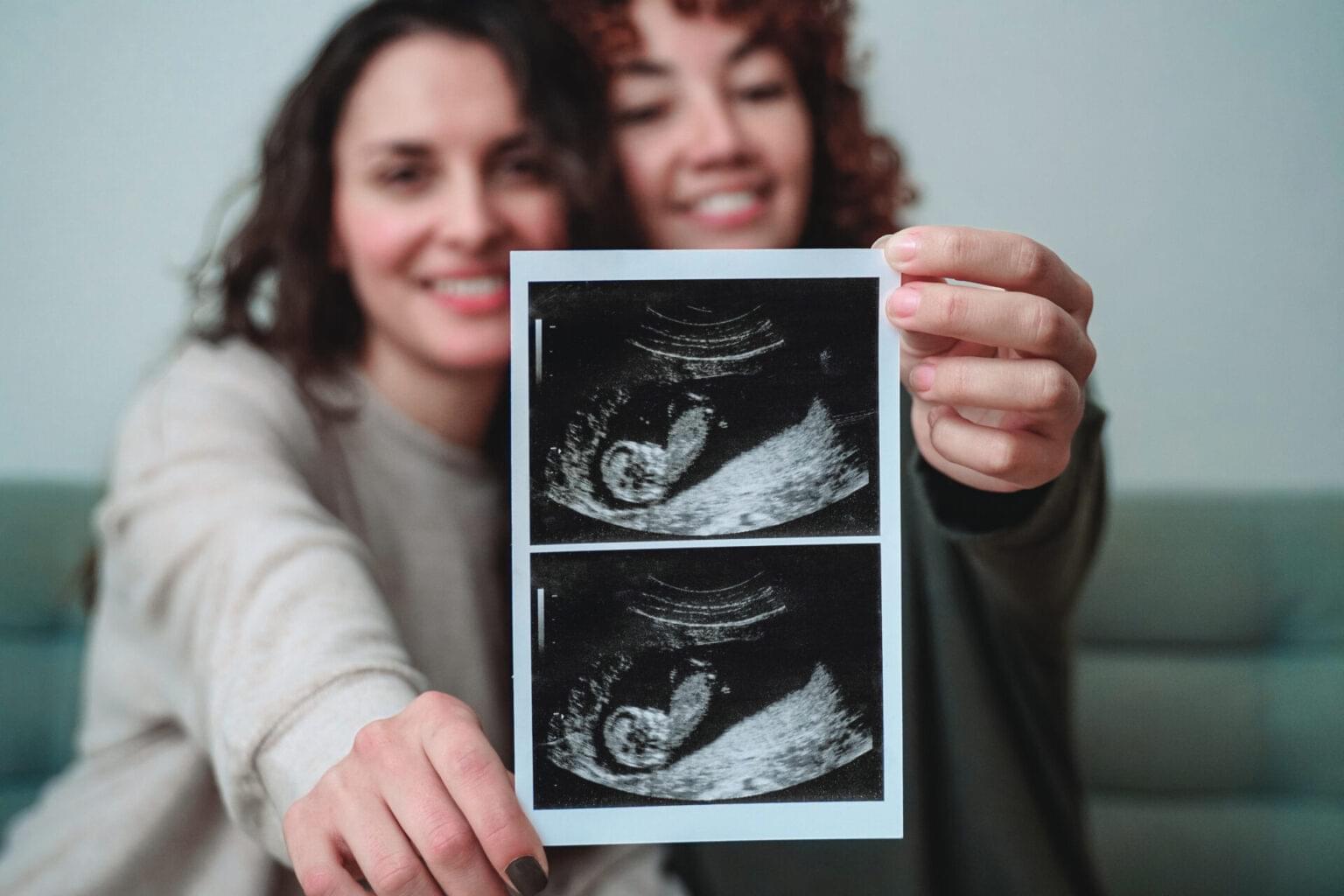 Early Pregnancy & Baby Scan | Private Ultrasound Elite Community